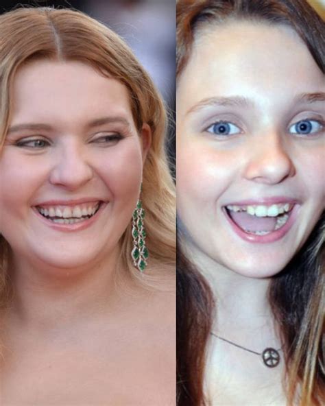 abigail breslin teeth|Abigail Breslin Bio